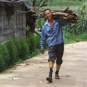 man with prosthetic leg walking