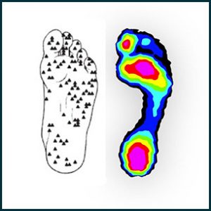 scan showing a diabetic foot