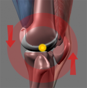 movement of knee joint on cartoon diagram