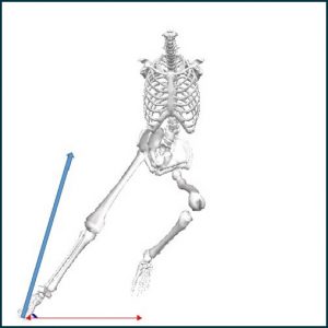 Diagram of a skeleton